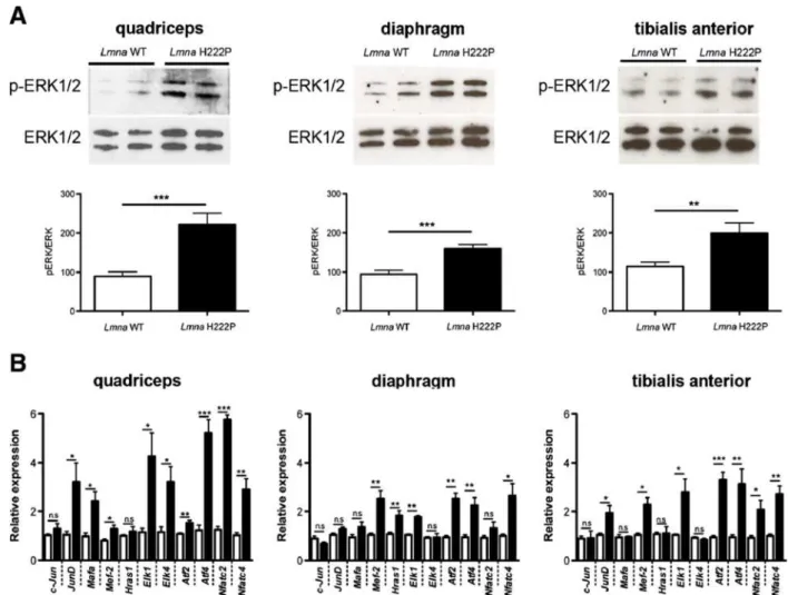Figure 2 Increased ERK1/2 activity in skeletal muscle of Lmna H222P/H222P mice. (A) Immunoblots showing phosphorylated ERK1/2 (p-ERK1/2) and total ERK1/2 in protein extracts from quadriceps, diaphragm, and tibialis anterior muscles of 20-week-old male wild