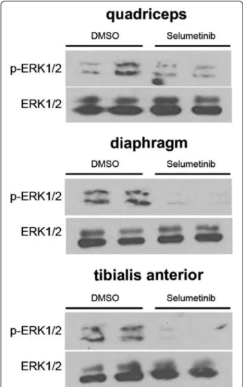 Figure 5 Selumetinib inhibits ERK1/2 phosphorylation in skeletal muscles from Lmna H222P/H222P mice
