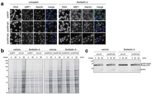 Figure 2. ARF4 depletion preserves Golgi morphology and protein trafficking upon BFA treatment