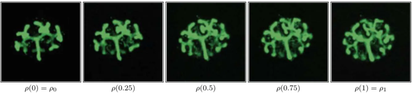 Fig 14 . Images of kidneys morphogenesis