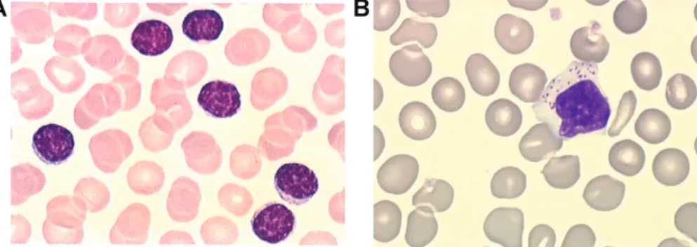 Figure 7. Frottis sanguins montrant des petits lymphocytes matures (A) ou des  grands lymphocytes à grains (B) (d’après Lamy et al