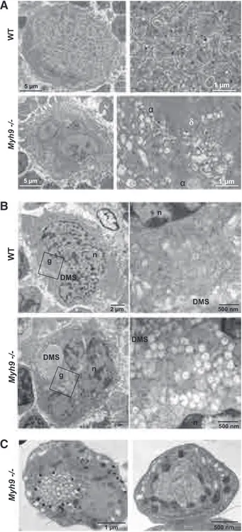 Figure 2. Abnormal MK distribution upon maturation of Myh9 2/2 MKs. (A) TEM images showing the in situ ultrastructure of WT (top panels) and Myh9 2/2 (bottom panels) MKs
