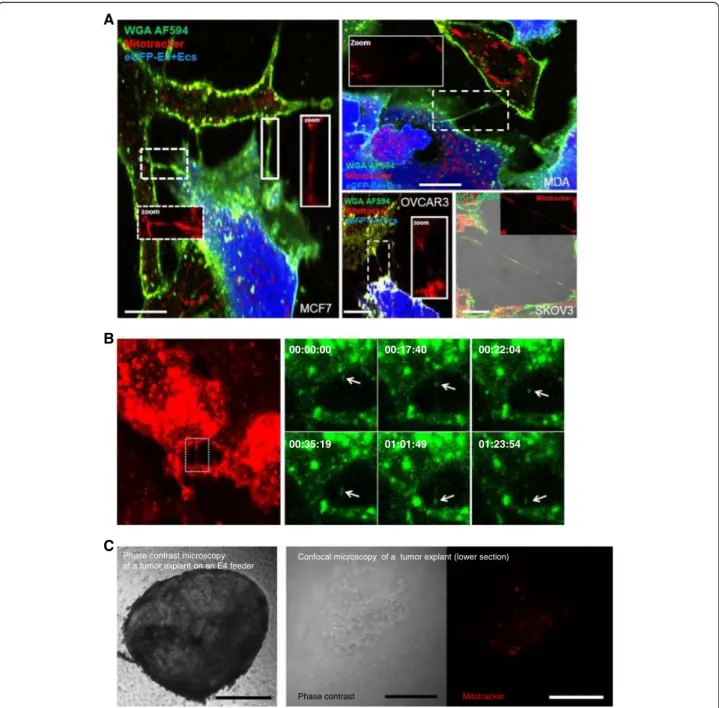 Figure 4 Transfer of Mitochondria between eGFP-E4 + ECs and cancer cells. A, confocal images of mitochondria transfer through TnTs.