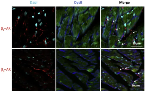 Fig. 6. Immunofluorescent co-labeling of ! 1 -adrenoceptors (ARs) or ! 3 -ARs and dystrophin B in heart from adjuvant-treated rats.