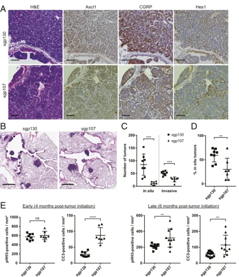 Fig. 4. Histological analysis of sgp130 and sgp107 tumors. (A) Representative H&amp;E (first column) and IHC staining of serial sections of tumors from Trp53/Rb1/