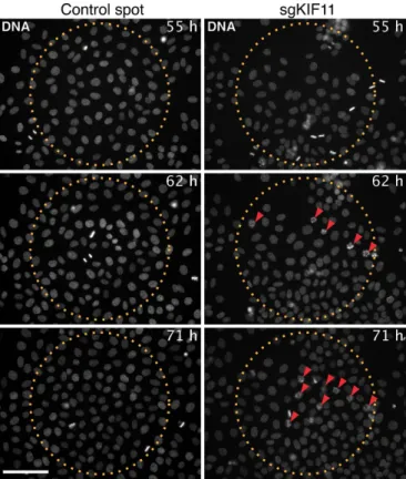 FIGURE 4:  Reverse transfection allows real-time imaging of depletion  phenotypes. Time-lapse stills of HeLa cells seeded on a printed  sgRNA array with control spots (left) or spots containing an sgRNA  targeting KIF11 (right)