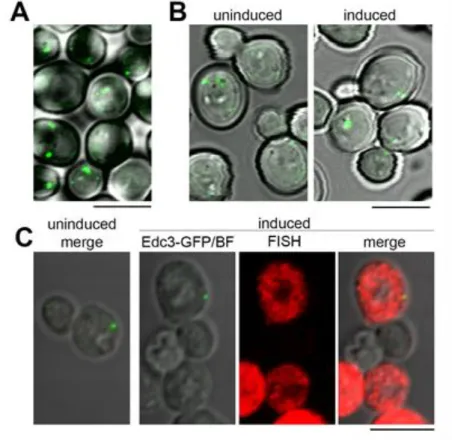 Figure 5. Expression of the model RNA does not induce formation of P bodies. (A): Live-cell imaging  of  nontransformed  EDC3-GFP  strain
