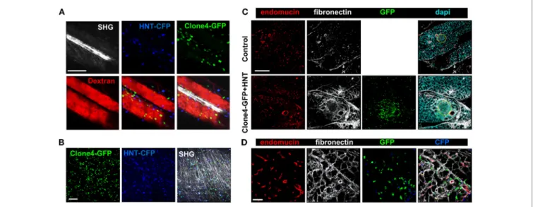 FigUre 4 | Effector T cells migrate along ECM fibers, which accumulate at infiltration sites