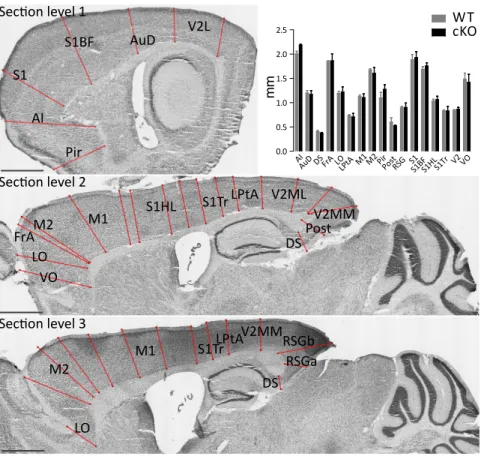 Figure 16.Cortical thickness measurements, Nissl staining. Measurements are performed on 3  different  sagittal  sectioning  levels,  red  lines  represent  ruler  (ROI)  positions,  scale  bars  1mm