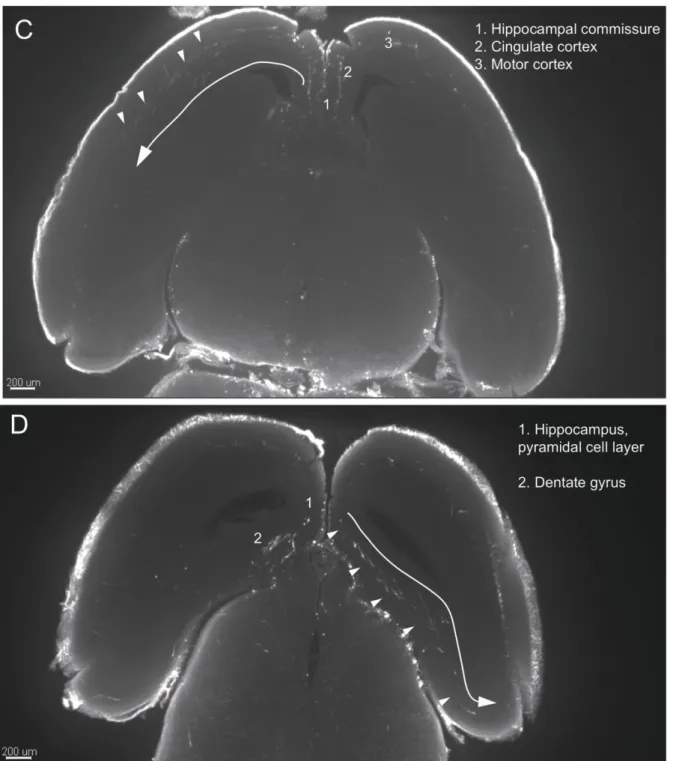 Figure 3. Serotonergic neurons and projections at E16.   