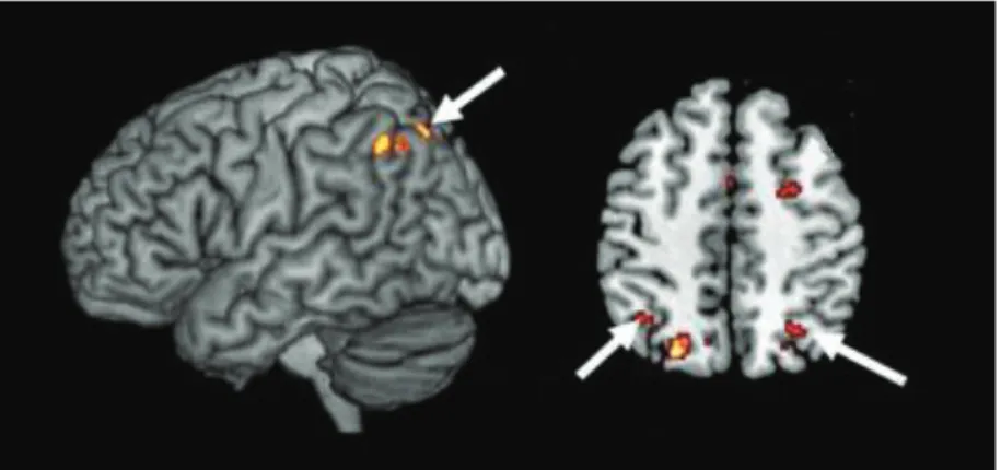 Figure 8. Principales régions cérébrales associées au raisonnement transitif linéaire