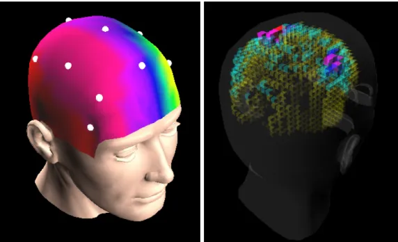 Figure 6: 3D display of brain activity. Left: 3D topographic display of brain activity in real-time, on the scalp