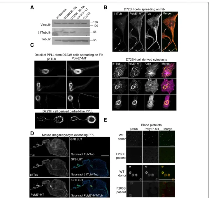 Fig. 3 β 1tubulin is expressed at low levels in D723H cells and is incorporated in polyE-rich MTs