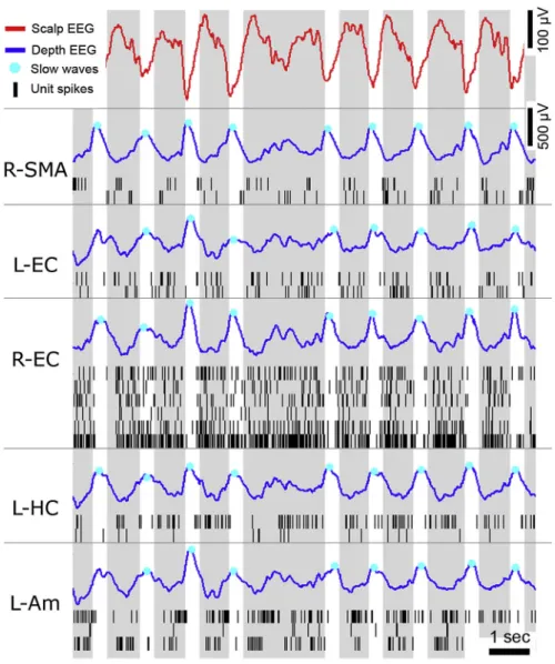 Figure 1-2 Example of EEG and single-unit activity during global sleep slow waves  