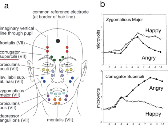 Figure 1. Electrode locations for measuring facial EMG  activity.