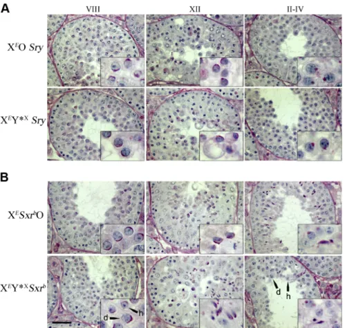 Fig 3. Addition of Y * X to X E O Sry or X E Sxr b O models does not improve spermiogenic progression.