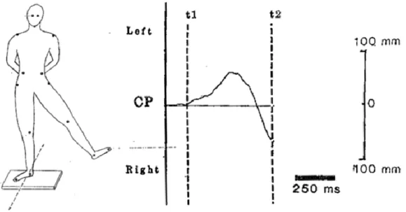 Figure 8 : Déplacement du Centre des pressions (CP) selon l’axe médio-latéral lors de l’initiation d’un  mouvement d’élévation de la jambe à 45° (adapté de Mouchnino et al