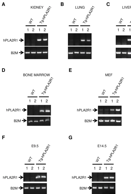 Figure 2.  Tissue genotyping on mice, embryos and their derived cells. (A–D) PCR analysis of extracted DNA  obtained from 6 months old Tg-hPLA2R1 and WT mouse tissues