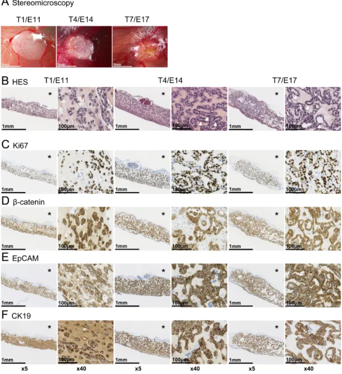 Figure 1: Histological and immunohistochemical analysis of experimental hepatoblastoma on the CAM