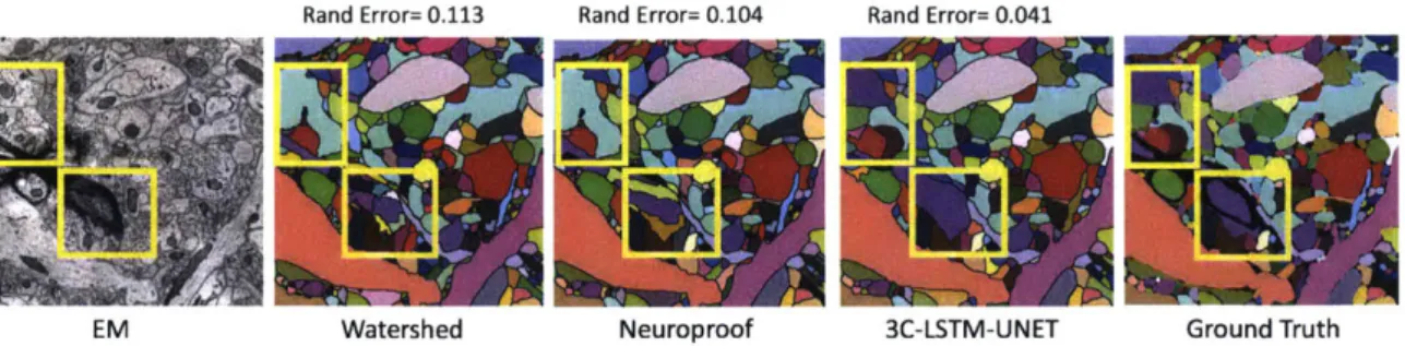 Figure  2-1:  SNEMI3D:  The  3C-LSTM-UNET  architecture:  Results  compared  with baseline  techniques:  Watershed,  Neuroproof,  and  ground  truth.