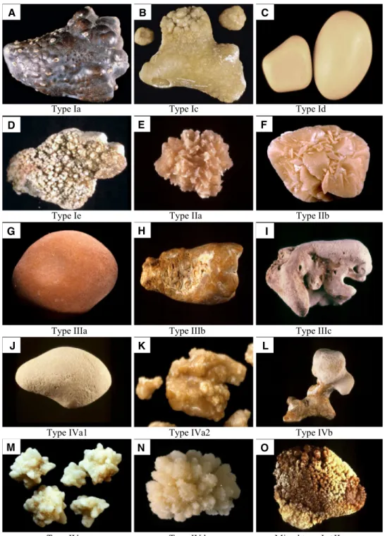 Fig. 1    Photographs of the  stone surface for the main  morphological types of urinary  calculi