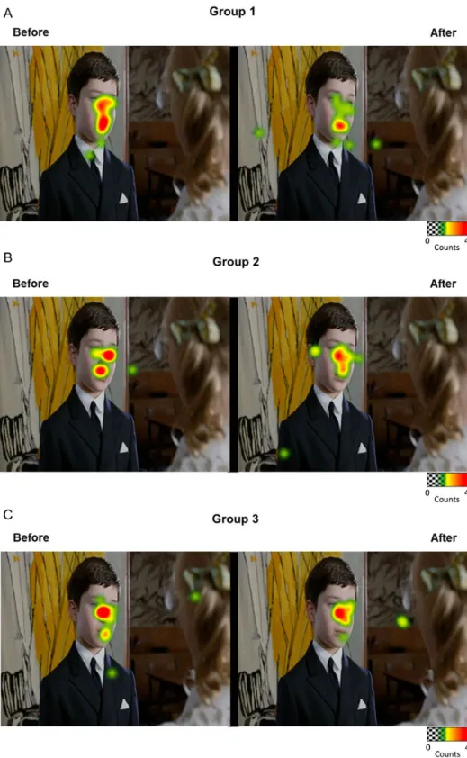 Figure 4. Whole-frame heatmaps representing group gaze behaviors before and after each intervention in (A) Group 1 (inhibitory TMS applied over the right pSTS), (B) Group 2 (Sham applied over the right pSTS), and (C) Group 3 (inhibitory TMS applied over th