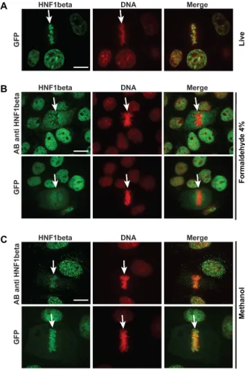 Figure 2. Effect of fixation on the mitotic localization of HNF1 ␤ . (A) Mi- Mi-totic localization of Nter-HNF1 ␤ -GFP fusion protein detected through the fluorescence of the GFP moiety with confocal microscopy in live MDCK cells