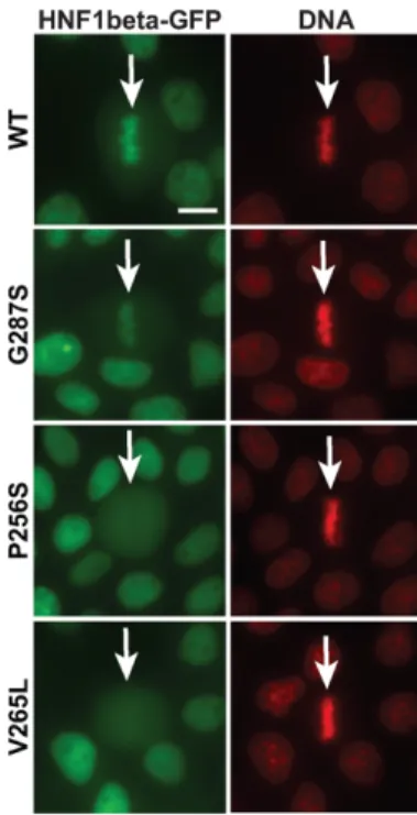 Figure 3. Mitotic chromatin localization defect of MODY mutants. Live imaging of MDCK cells expressing Nter-HNF1 ␤ -GFP (WT or MODY mutants) counterstained with Hoechst 33342 (red signal, DNA)