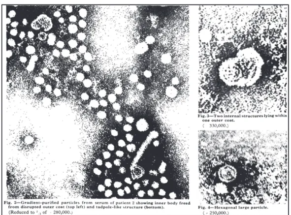 Figure 1: HBV complete virions and subviral particles. Original electron microscopy pictures taken by  Dane and colleagues