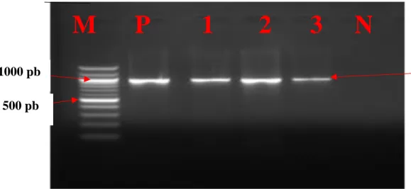 Figure 20: Profil électrophorétique du gène tetA de la résistance aux cyclines détectée 