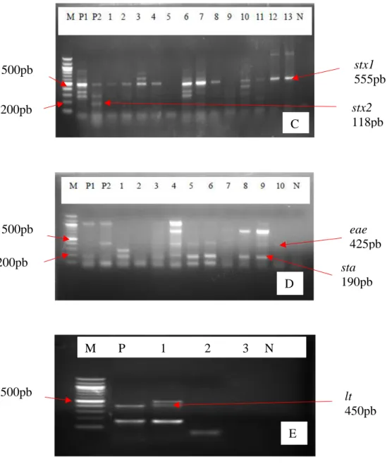Figure 22: Profils électrophorétiques des gènes de virulence détectés chez E. coli 