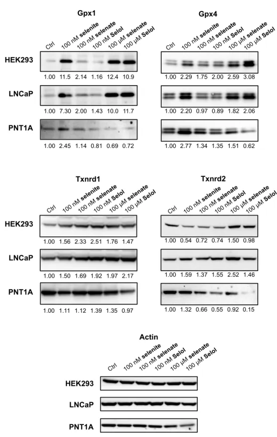Figure 6. Analysis of selenoprotein regulation by selenite, selenate or Selol supplementation in  different cell lines