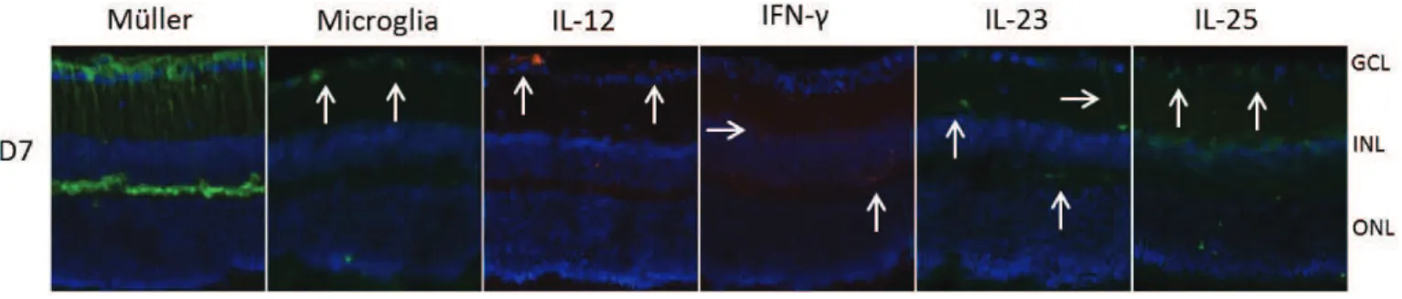 Figure 16 : Localisation de la production de cytokines et de cellules dans les rétines infectées