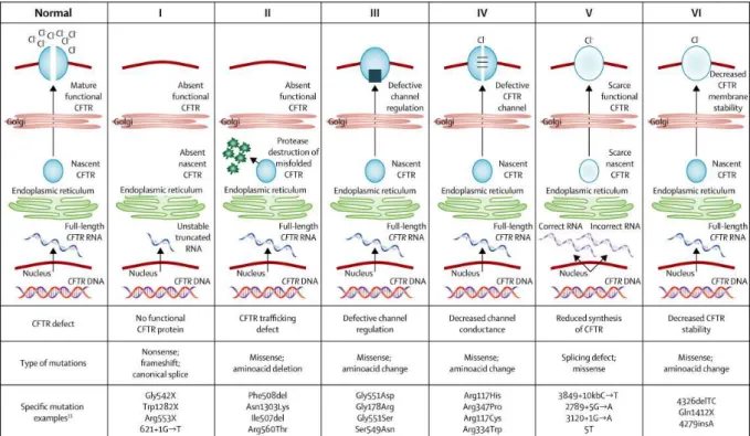 Figure 5 : Les 6 classes de mutations du gène CFTR, selon Boyle et de Boeck (2013). 