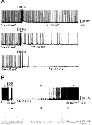 FIG . 1. Effect of high-frequency stimulation (HFS) on the spontaneous single-spike activity of 2 subthalamic nucleus (STN) neurons