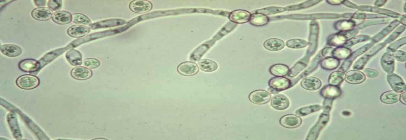 Figure 6 : Aspect des chlamydoconidies en culture (C. albicans) (MARTINE, 2007)                    Grossissement : 400 X 