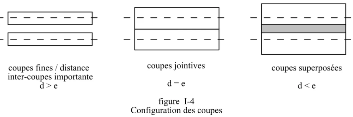 figure  I-4  Configuration des coupescoupes fines / distance 