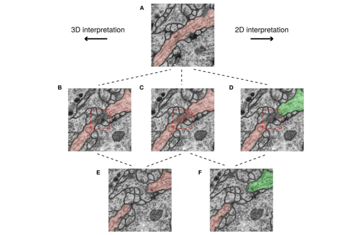 FIGURE 6 | Minor ambiguities in 3D can become significant in 2D. Three rows correspond to three successive slices in the image stack and each path shows a possible segmentation of a neuron based on a different interpretation