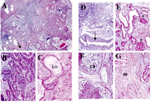 Figure 11  :  Histologie des tératocarcinomes obtenus après injection sous-cutanée de  cellules ES chez la souris