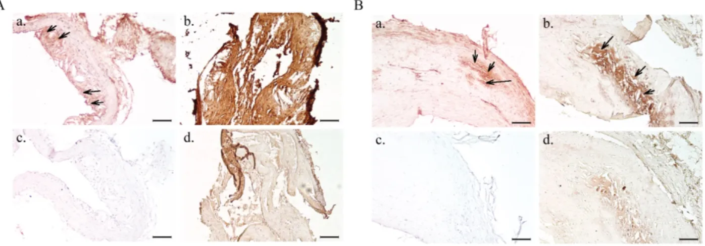 Figure 3. IHC analysis of aorta sections from hypercholesterolemic Apoe −/−  mice (A) and human endarterectomy samples  (B)