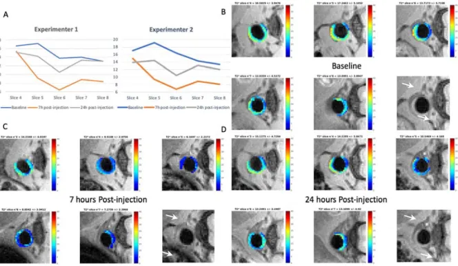 Figure 4. In vivo atheroma T 2 * variations after injection of NE-P3 (#5). (A): Diagrams made by two experimenters repre- repre-senting the T 2 * mean values (in ms) for each slice of the abdominal aorta of one Apoe −/−  mouse at baseline, 7 h, and 24 h  a