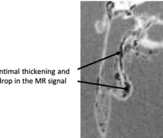Figure 5. MRI magnitude image of the agarose-embedded aorta after isolation from one Apoe −/−