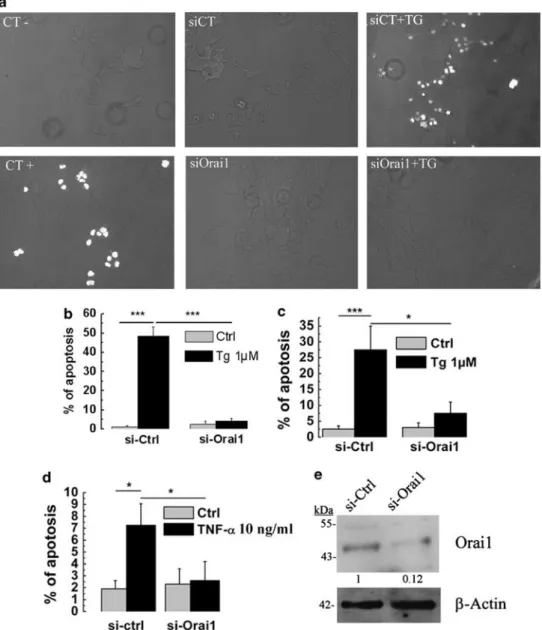 Figure 4d). The control of CFP-tagged Orai1 and YFP-tagged STIM1 transfections into LNCaP cells was performed using confocal microscopy (Figure 4e)