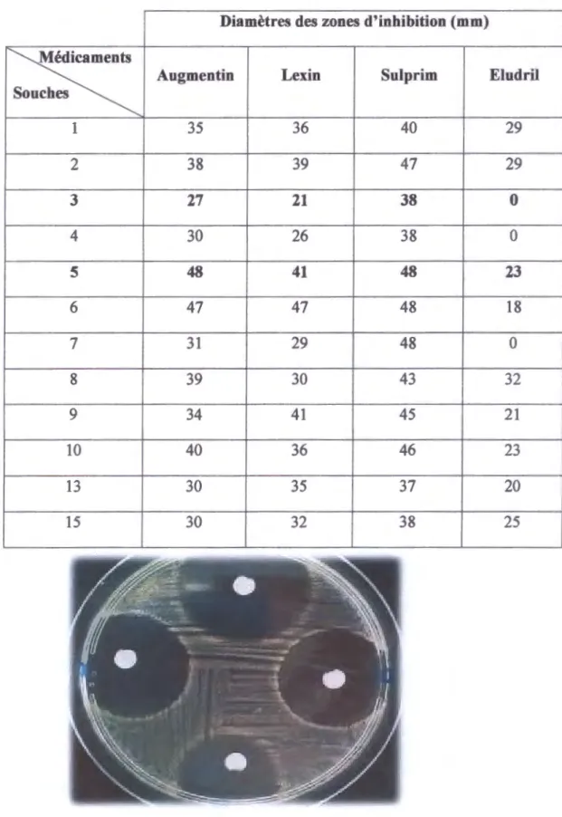 Tableau 5 : Valeurs des diamètres des zones d'inhibition des dilutions  10- 1  (mm). 