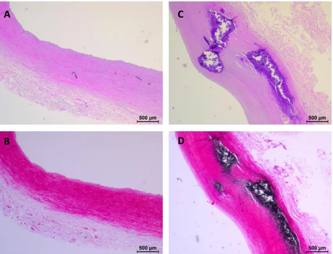 Figure  1.  Histology  of  human  arteries.  Representative  pictures  of  hematoxylin  and  eosin- eosin-staining  (A, C) and von Kossa-eosin-staining (B, D) of iliac arteries sections from an early (A, B) and  an advanced (C, D) CVD patient