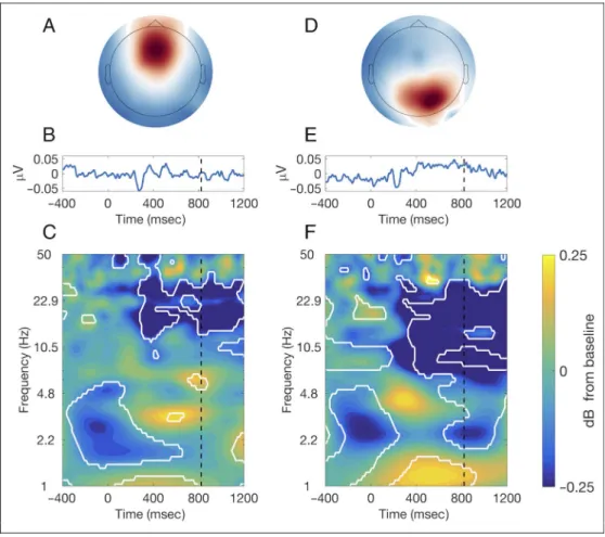 Figure 5. (A) Topographical map showing the activation pattern of the 6-Hz spatial filter;