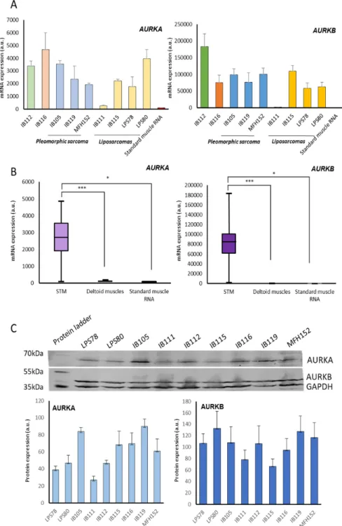 Figure 2. Characterisation of AURKA and AURK B expressions in STS cell lines and normal tissues
