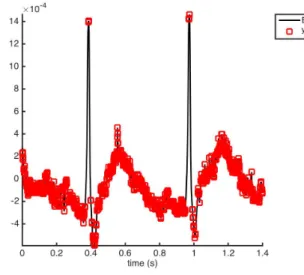 Fig. 2. Demonstration of level crossing sampling on a small ECG fragment.