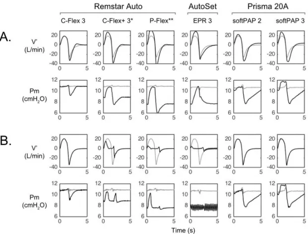 Figure  1:  Measured  mask  airflow  and  pressure  waveforms  of  fixed-CPAP  with  (black  curves)  and 3 