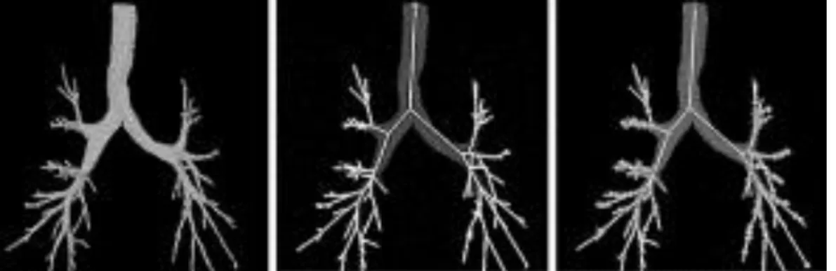 FIGURE 1.3: The matching example of branch points from airway trees of different subjects  (B